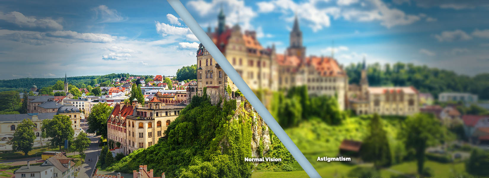 Astigmatism Treatment in Elk Grove Village