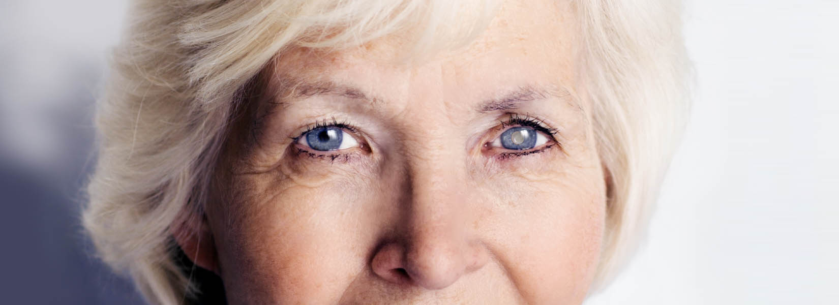 Cataract Surgery in Elk Grove Village